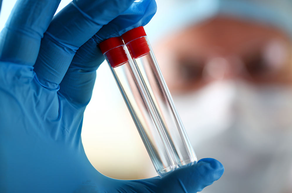 Person holding a sample tube in their hand - close up